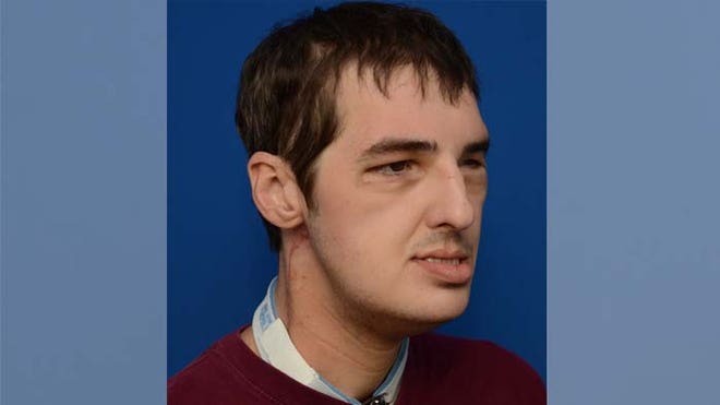 Seven months after transplant.jpg